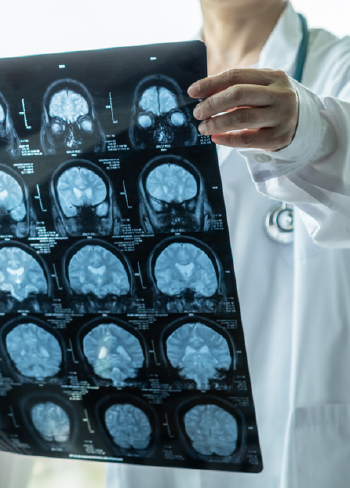 Image Neurology