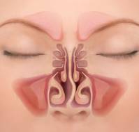 Is nasal blockage a common problem?