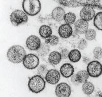 क्या है हंता वायरस, कैसे फैलता है और क्या है इसके लक्षण ?