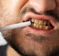 How Does Smoking and Tobacco Affect Oral Health?
