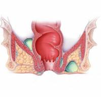 Discuss about anorectal conditions?