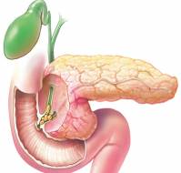 Discuss the management of asymptomatic gallstones in the diabetic patient?