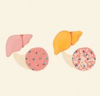 What is the Diet for Cirrhosis of the liver?