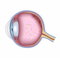 How is the retina examined?