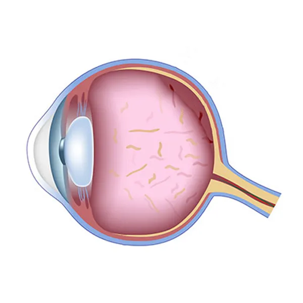 How is the retina examined?