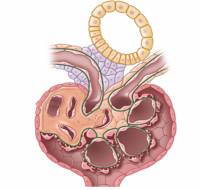 How to differentiate a glomerular and tubulointerstitial CKD?