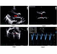 How reliable are echo-guided hemodynamic parameters?