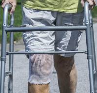Is there a need for walker, crutches, or cane or other help after knee replacement surgery?