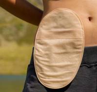 Ostomy Surgery: All You Need To Know