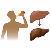 Prevalence and Risk Factors for Alcohol Related Liver Diseases