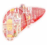Treatment of Alcohol related Liver Injury