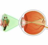 What is retinopathy of prematurity (ROP)?