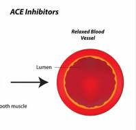 What is the alternative if the patient cannot tolerate ace inhibitors?