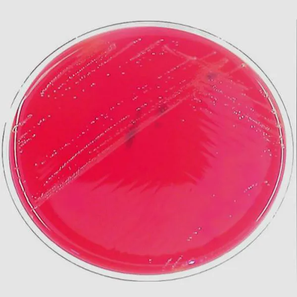 What is urine culture?