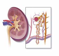 What questions can be asked on nephrotic syndrome?