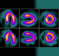 What are various important points to be assessed in myocardial perfusion scintigraphy?