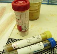What is a stool culture test?