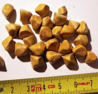What is an asymptomatic gallstone?