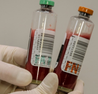What is blood culture?