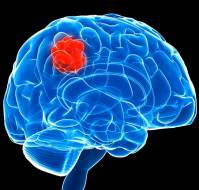 What treatment options are available for patients facing a brain tumor recurrence?