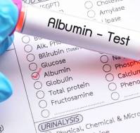 What you need to know about Albumin Test