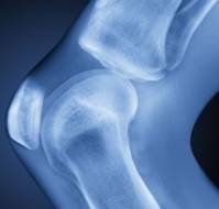 Which joints are commonly involved in osteoarthritis?