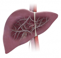 Alcoholic Liver Disease: Interpreting SGOT and SGPT Levels for Disease Progression