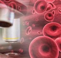 Aplastic Anemia: Causes, Symptoms and Treatment - Medtalks