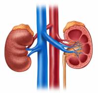 Can bypass be done along with renal artery stenosis?