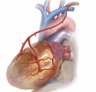 What is total arterial bypass surgery?