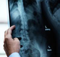 X-Ray: Imaging Tests For Clinical Diagnosis
