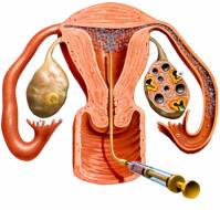 How do we induce ovulation?