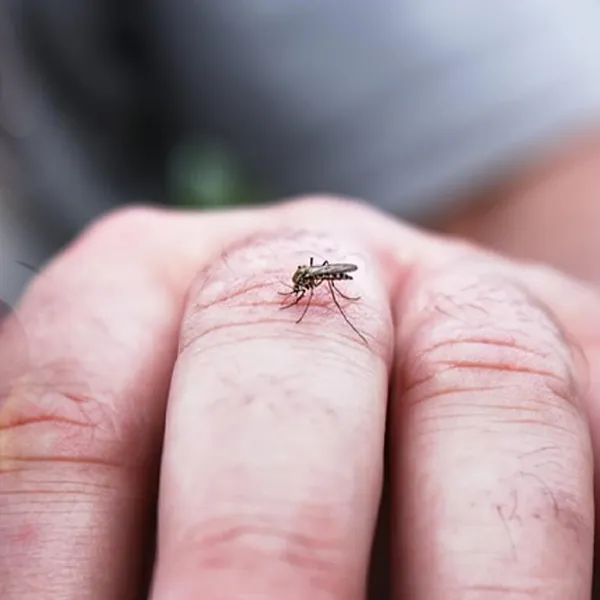 How should we manage a patient with Dengue Fever?