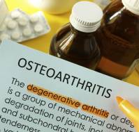 What is the medical management of osteoarthritis?