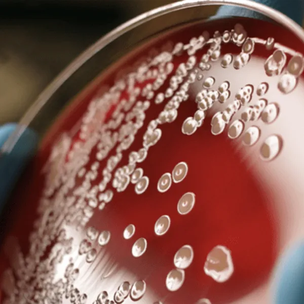 What is the need for sepsis code?