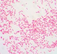 What are the common Gram-negative organisms showing AMR?