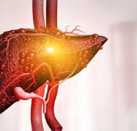 Non-alcoholic Fatty Liver Disease (NAFLD) and the Role of SGOT and SGPT in Diagnosis and Monitoring