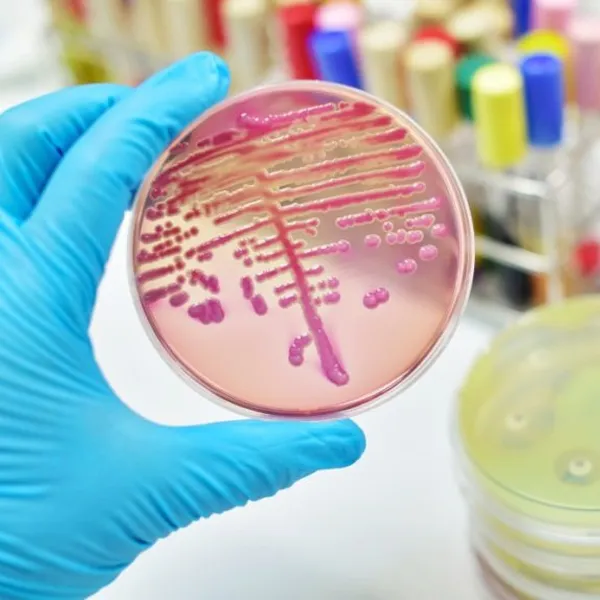 What are the important points to be considered in sepsis and septic shock?