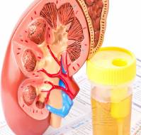 How should we manage patients of mild kidney disease in patients with GFR more than 60?