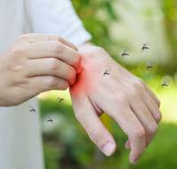 जीका वायरस क्या है? कारण, लक्षण और इलाज| Zika Virus in Hindi