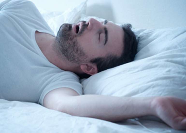 स्लीप एपनिया के कारण, लक्षण, इलाज और प्रकार| Sleep Apnea in Hindi