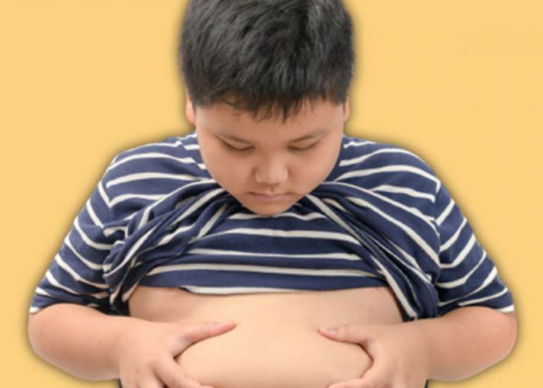 A Scoping Review of the Role of Childhood Obesity in Early-Onset Type 2 Diabetes Mellitus