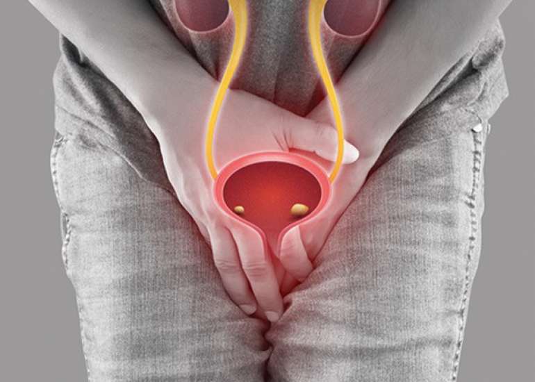 Vaginal Stone Formation Associated with Retained IUD in an Obese Patient