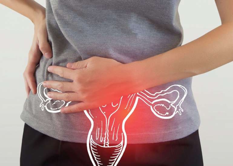 Impact of Metformin Therapy on Inflammatory Markers and Insulin Resistance in Women with Polycystic Ovary Syndrome (PCOS)