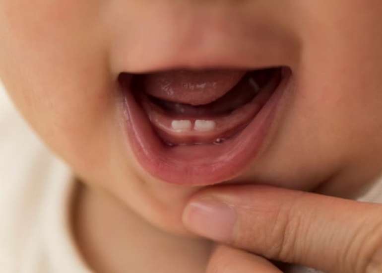 Examining the Impact of Teething on Infant Sleep: A Study of Auto-Videosomnography Measurements