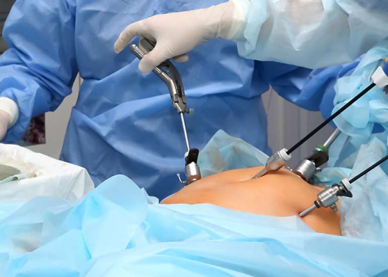 Contrasting the Effectiveness of Bupivacaine Injection in Vaginal Vault and Paracervical Region Versus Vaginal Vault Infiltration with Bupivacaine After Total Laparoscopic Hysterectomy