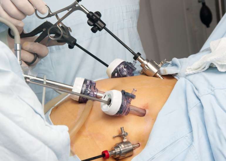 Endocrine Effects of Bariatric Surgery: Benefits, Risks, and the Need for Comprehensive Care