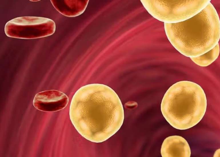 Management of Dyslipidemia in Diabetes