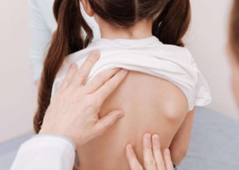 Cardiac Complications in Children with Shigella Encephalopathy