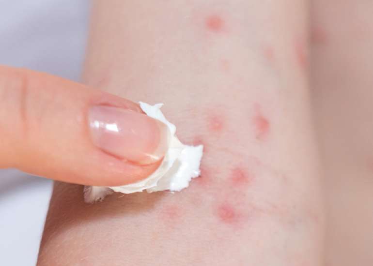 Challenges and Insights in Preventing Food Allergies through Skin Barrier Interventions